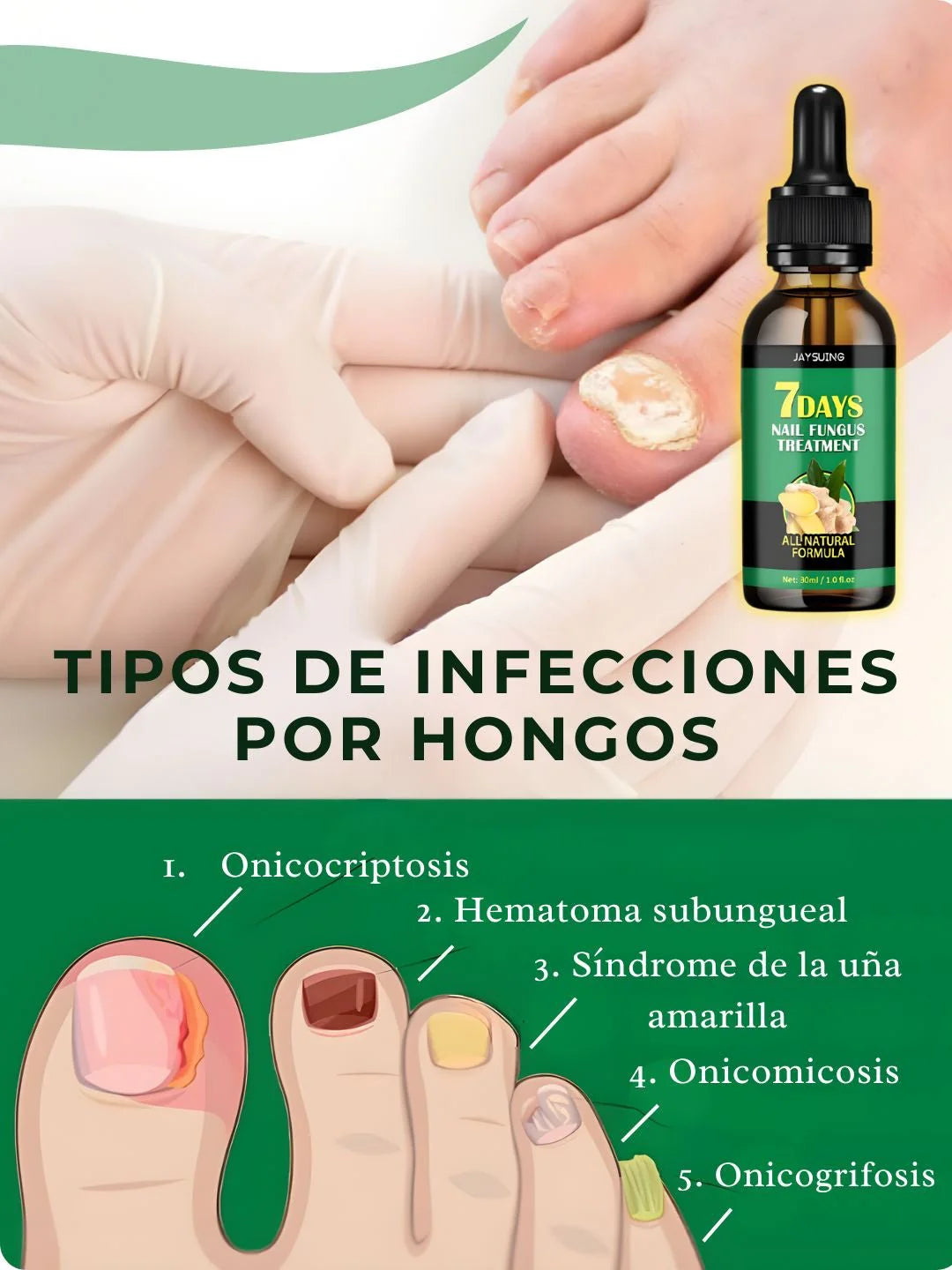 Serum Clínico 7 Days® | Eliminación de Hongos en Uñas Desde la Raíz