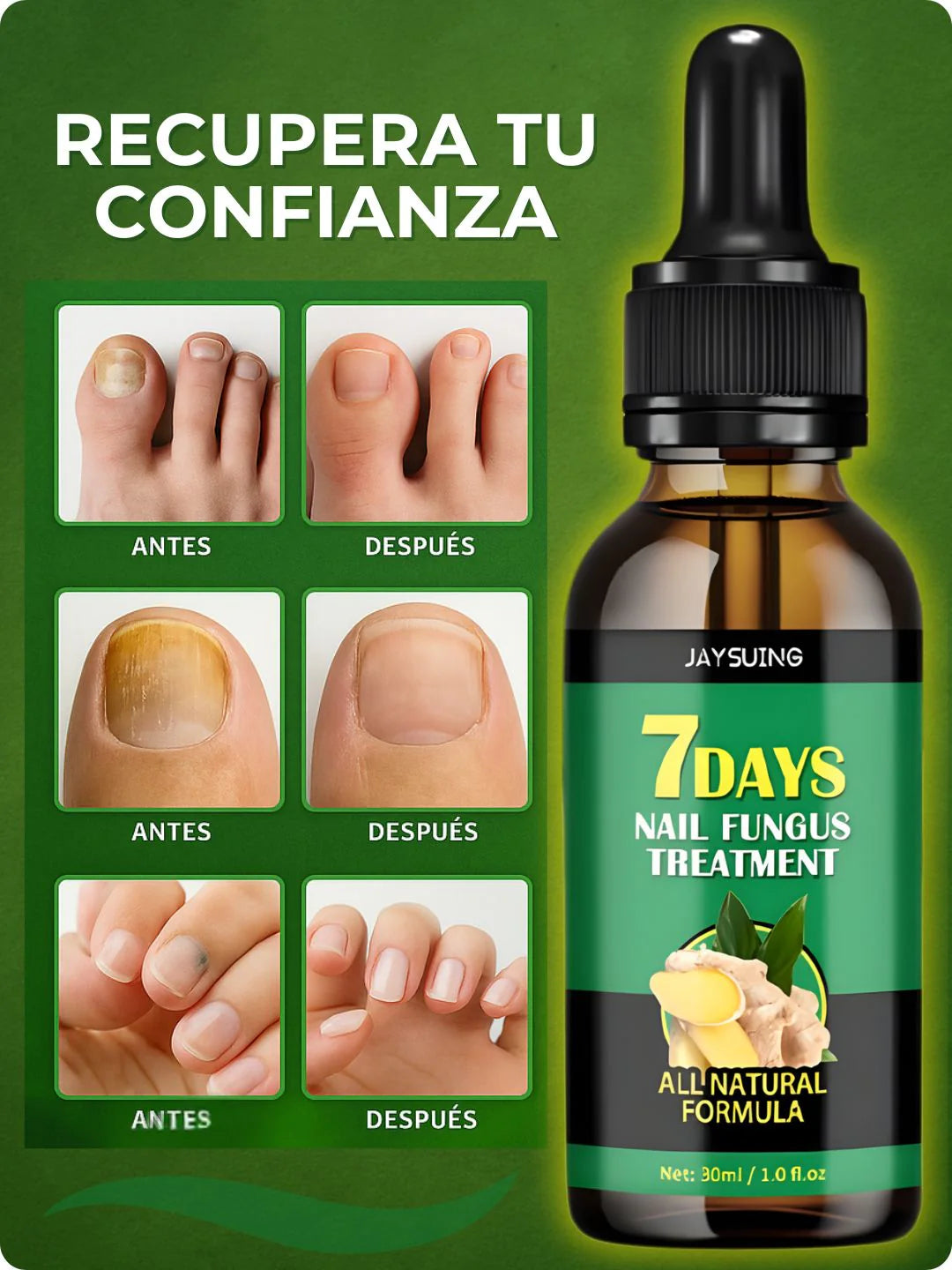 Serum Clínico 7 Days® | Eliminación de Hongos en Uñas Desde la Raíz